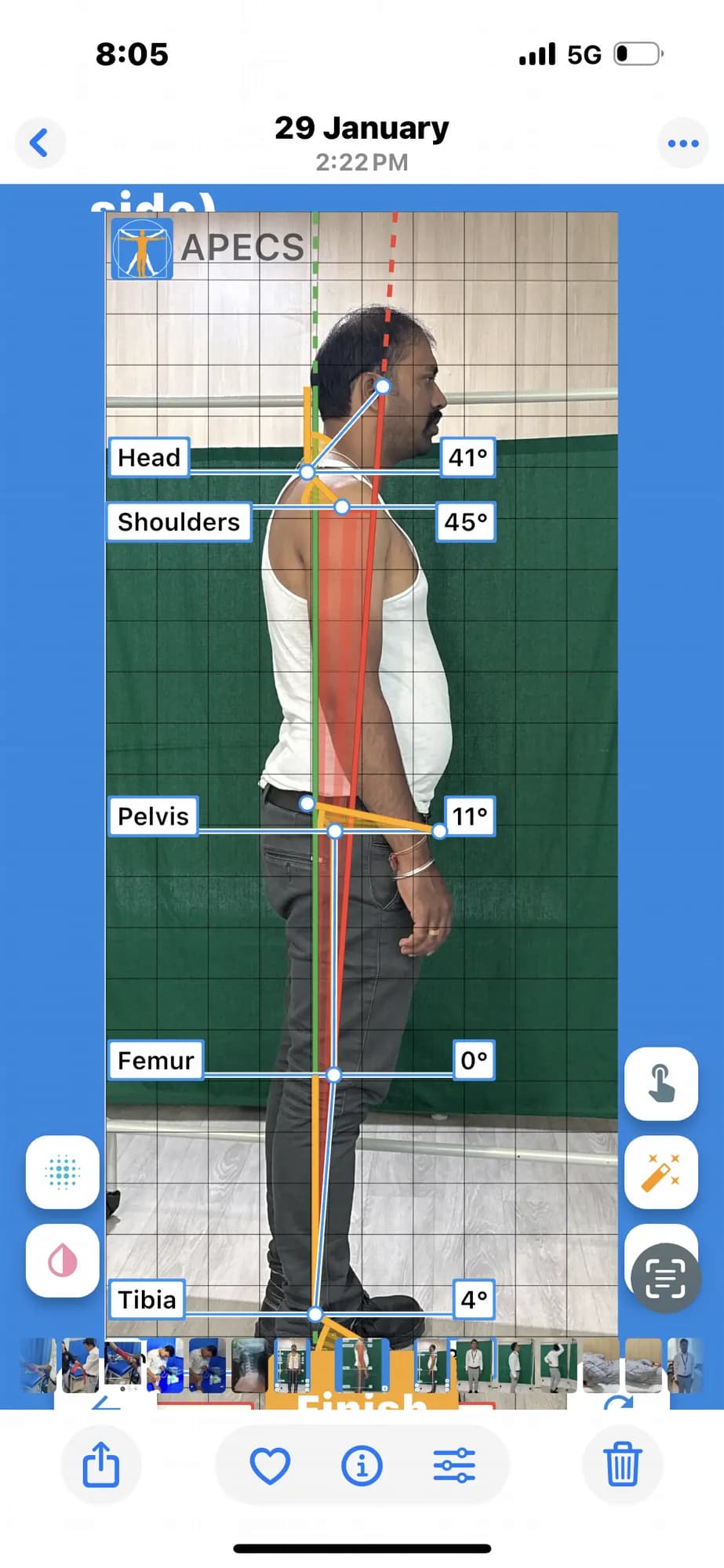 Manual therapy for knee osteoarthritis and patellofemoral pain at Pro Physiotherapy JP Nagar 8th Phase Bengaluru
