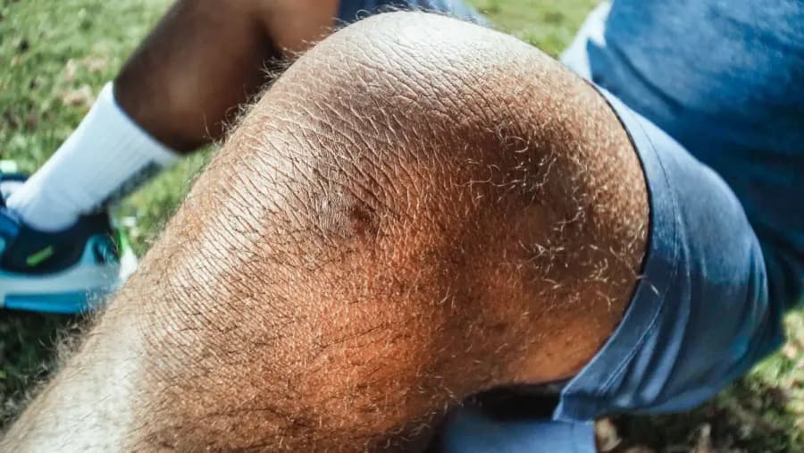 Is Running Safe for Knee Osteoarthritis Patients Bangalore Is running safe for knee osteoarthritis Bangalore — knee joint anatomy and cartilage protection during recreational running, evaluated at Pro Physiotherapy JP Nagar sports physiotherapy
