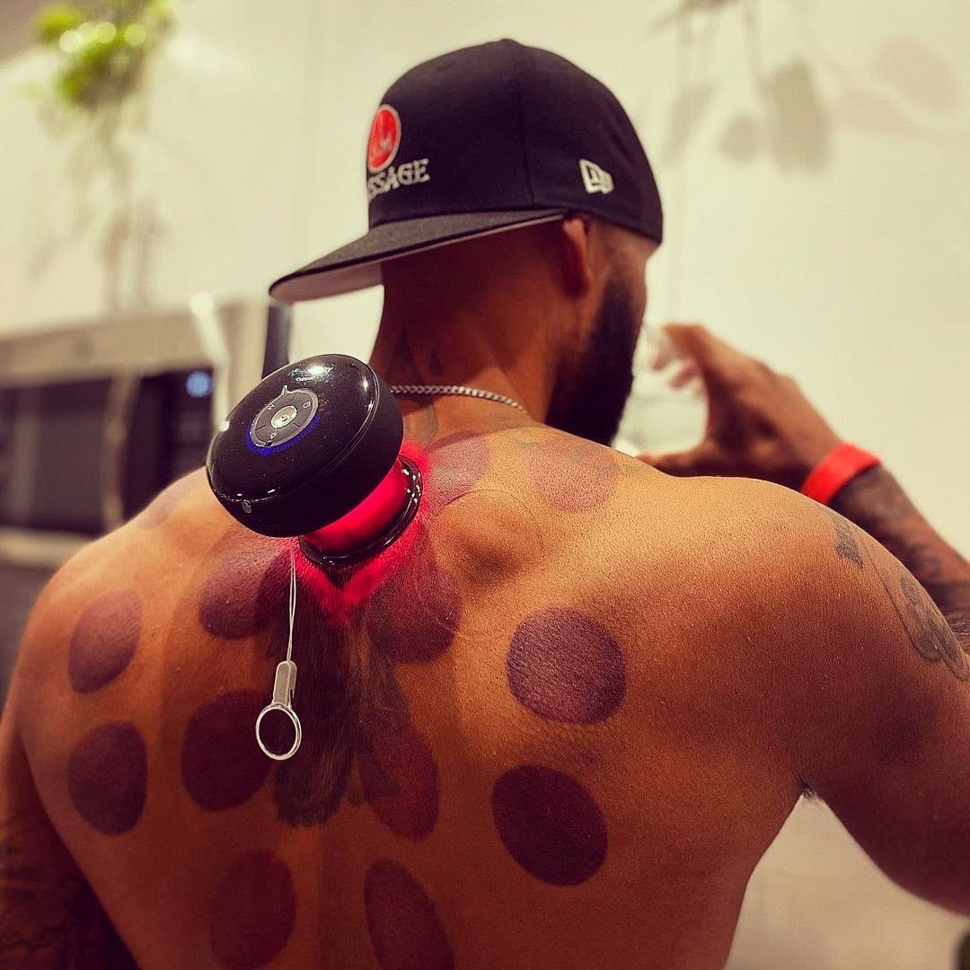 benefits-of-cupping-therapy